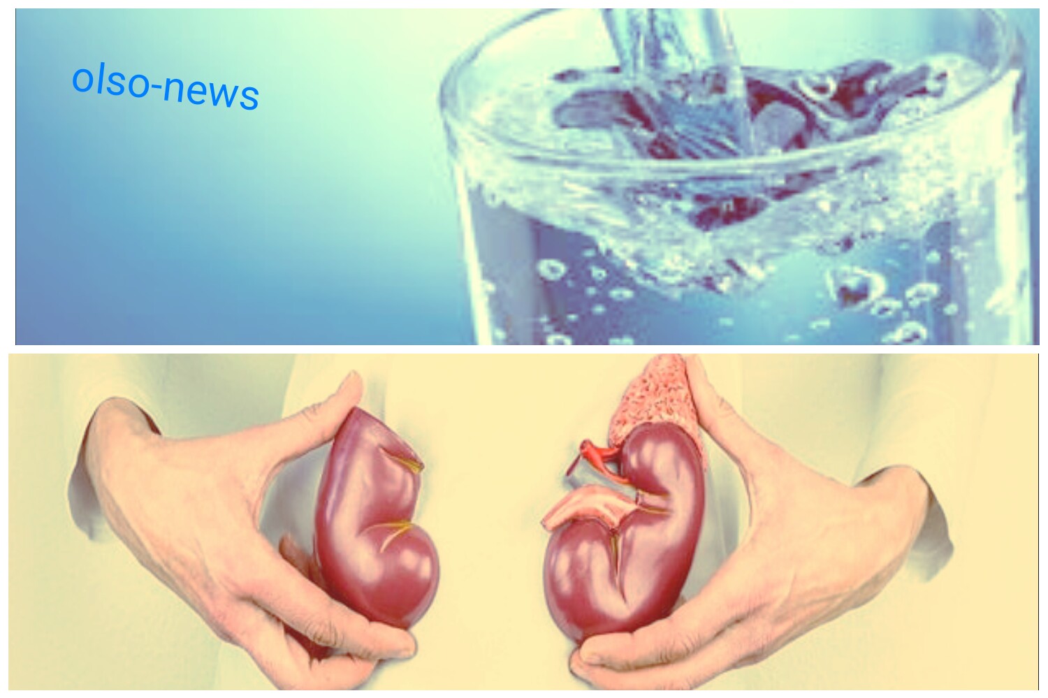 الجفاف الشديد في الكلى داخل جسم الأنسان بسبب نقص عملية شرب الماء با الكمية الكافية